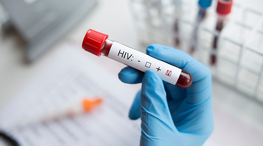 Frontiers in HIV: Sailing in the scientific perspective
